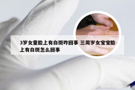 3岁女童脸上有白斑咋回事 三周岁女宝宝脸上有白斑怎么回事