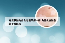 身皮肤肤为什么老是干癣一样 为什么皮肤总是干燥起皮