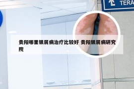 贵阳哪里银屑病治疗比较好 贵阳银屑病研究院