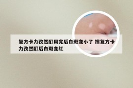 复方卡力孜然酊用完后白斑变小了 擦复方卡力孜然酊后白斑变红