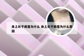 身上长干癣是为什么 身上长干癣是为什么原因