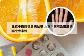 北京中医院银屑病贴吧 北京中医院治银屑病哪个专家好