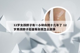 12岁女孩脖子有一小块白斑十几年了 12岁男孩脖子后面有白斑怎么回事