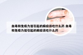 血毒和免疫力低引起的癣应该吃什么药 血毒和免疫力低引起的癣应该吃什么药