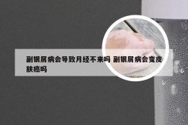 副银屑病会导致月经不来吗 副银屑病会变皮肤癌吗