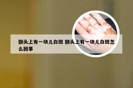 额头上有一块儿白斑 额头上有一块儿白斑怎么回事