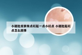 小腿肚皮肤有点红起一点小红点 小腿肚起红点怎么回事