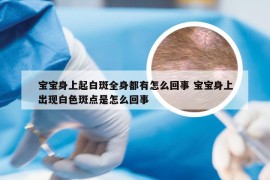 宝宝身上起白斑全身都有怎么回事 宝宝身上出现白色斑点是怎么回事