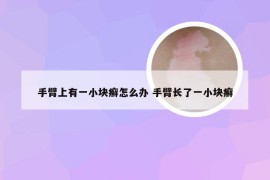 手臂上有一小块癣怎么办 手臂长了一小块癣