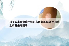 孩子头上有像癣一样的东西怎么解决 小孩头上有藓是咋回事