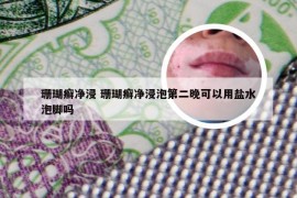 珊瑚癣净浸 珊瑚癣净浸泡第二晚可以用盐水泡脚吗