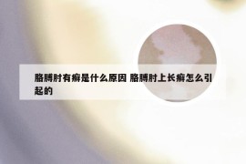 胳膊肘有癣是什么原因 胳膊肘上长癣怎么引起的