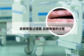 白斑恢复过程图 白斑恢复的过程