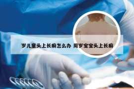 岁儿童头上长癣怎么办 周岁宝宝头上长癣