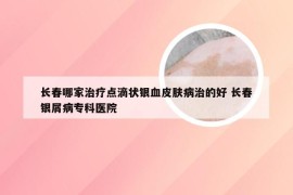 长春哪家治疗点滴状银血皮肤病治的好 长春银屑病专科医院