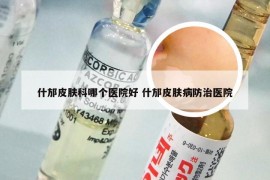 什邡皮肤科哪个医院好 什邡皮肤病防治医院