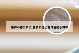 胳膊小腿出白斑 胳膊和腿上有白色的小斑块