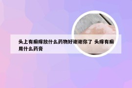 头上有癣痒放什么药物好谢谢你了 头痒有癣用什么药膏