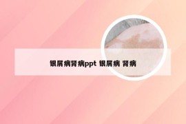 银屑病肾病ppt 银屑病 肾病