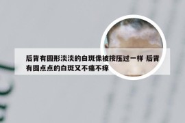 后背有圆形淡淡的白斑像被按压过一样 后背有圆点点的白斑又不痛不痒