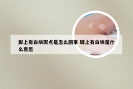 脚上有白块斑点是怎么回事 脚上有白块是什么意思