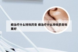 癣治疗什么特效药膏 癣治疗什么特效药膏效果好