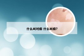 什么叫对癣 什么叫癣?