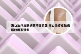 海口治疗皮肤病医院哪家强 海口治疗皮肤病医院哪家强些