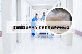 家用银屑病光疗仪 家用银屑病光疗仪价格