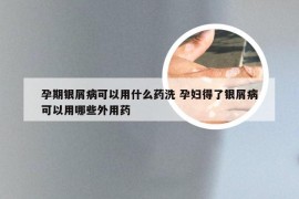 孕期银屑病可以用什么药洗 孕妇得了银屑病可以用哪些外用药