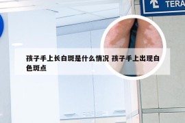 孩子手上长白斑是什么情况 孩子手上出现白色斑点