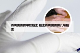 白斑需要做哪些检查 检查白斑需要做几项检查