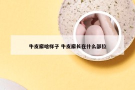 牛皮廨啥样子 牛皮廨长在什么部位