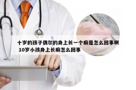 十岁的孩子偶尔的身上长一个癣是怎么回事啊 10岁小孩身上长癣怎么回事