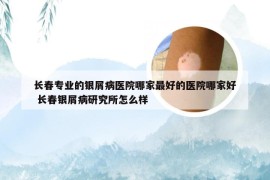 长春专业的银屑病医院哪家最好的医院哪家好 长春银屑病研究所怎么样