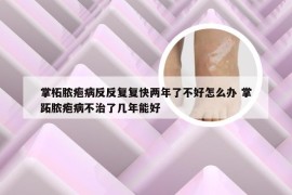 掌柘脓疱病反反复复快两年了不好怎么办 掌跖脓疱病不治了几年能好