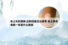 身上长的像癣,还刺挠是怎么回事 身上痒有像癣一样是什么原因