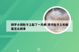 四岁小孩肚子上起了一片癣 孩子肚子上长癣是怎么回事