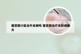 猪苦胆汁能治牛皮癣吗 猪苦胆治疗皮肤病偏方