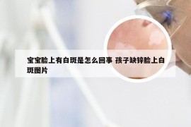 宝宝脸上有白斑是怎么回事 孩子缺锌脸上白斑图片