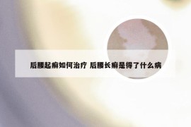 后腰起癣如何治疗 后腰长癣是得了什么病