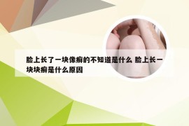 脸上长了一块像癣的不知道是什么 脸上长一块块癣是什么原因