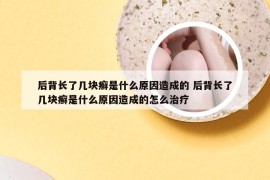 后背长了几块癣是什么原因造成的 后背长了几块癣是什么原因造成的怎么治疗