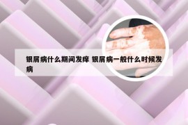 银屑病什么期间发痒 银屑病一般什么时候发病