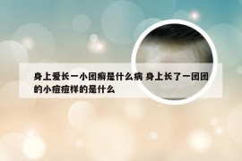 身上爱长一小团癣是什么病 身上长了一团团的小痘痘样的是什么