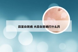 蒜苗白斑病 大蒜白斑病打什么药