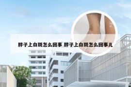 脖子上白斑怎么回事 脖子上白斑怎么回事儿