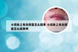 小孩身上有白斑是怎么回事 小孩身上有白斑是怎么回事啊