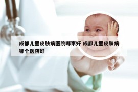 成都儿童皮肤病医院哪家好 成都儿童皮肤病哪个医院好