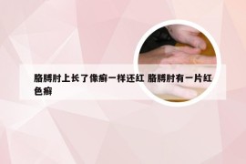 胳膊肘上长了像癣一样还红 胳膊肘有一片红色癣